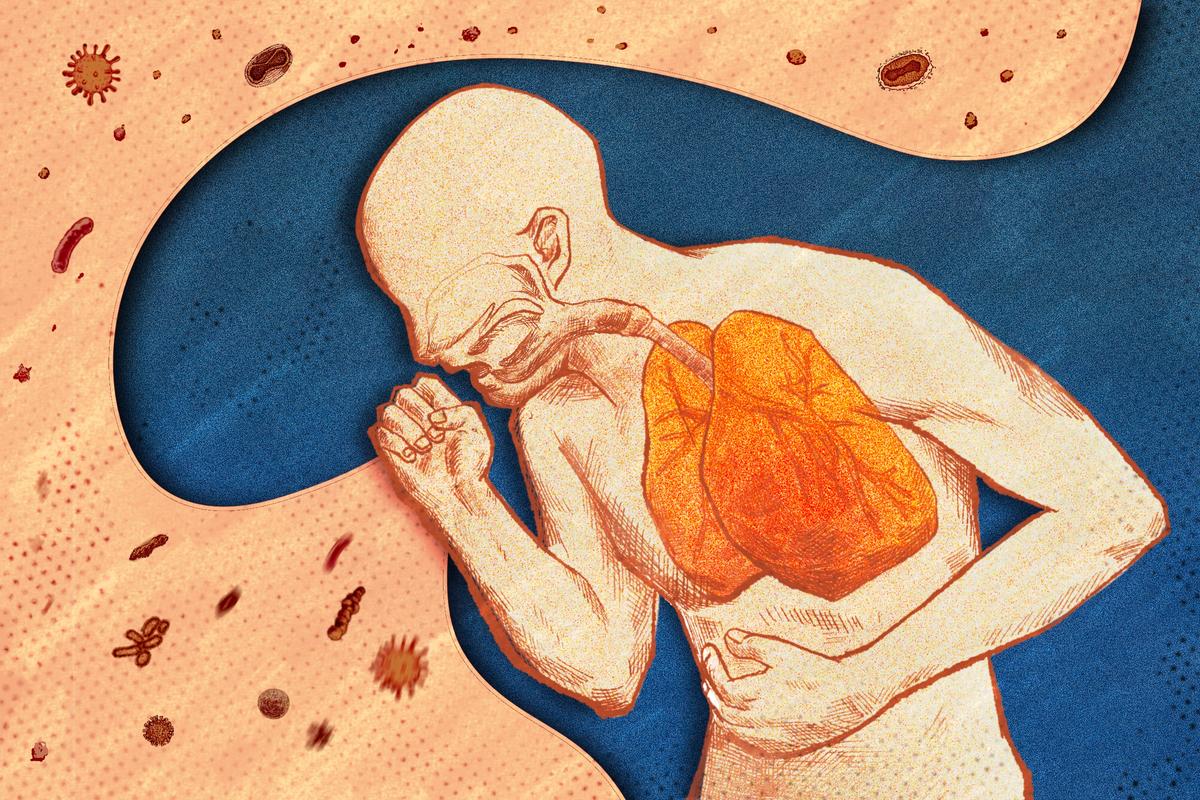 The Causes of Coughs, and How to Fix Them thumbnail